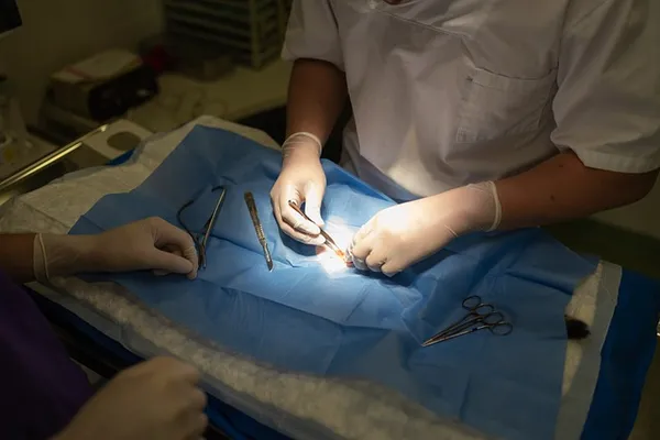 Chirurgischer Eingriff mit blauem Abdecktuch und Instrumenten